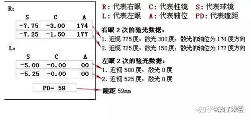 验光配镜时电脑小单怎么看