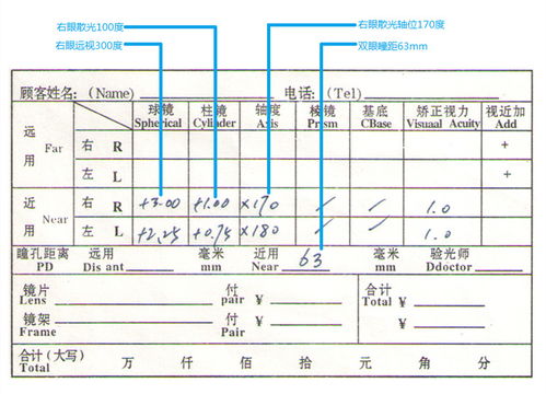 验光单完全看不懂 看完这篇让你成为半个验光师